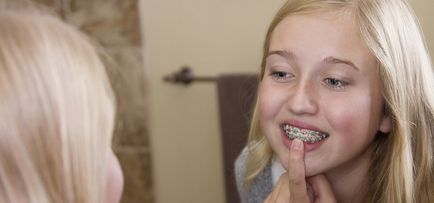 Ce mai bine pentru a pune aparat dentar preț adolescent și recenzii