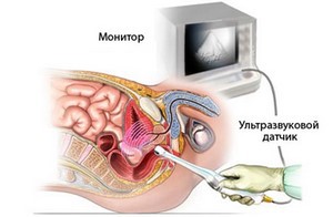 Cum să se pregătească pentru prostata si ultrasunete vezicii urinare