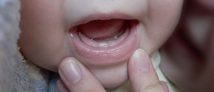 Cum de a ajuta copilul dumneavoastră atunci când dentiție rând simptome