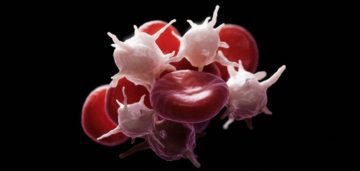 Cum de a crește trombocitele în sânge de remedii populare, acasă, și mai mult