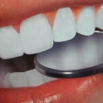 Cum de a vindeca un dinte la domiciliu