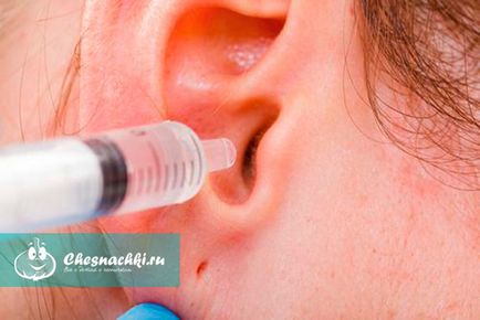 Cum să scoateți ștecherul din priză din urechi la domiciliu - o metodă eficientă (plută) Cum să scoateți ștecherul din priză din urechi la domiciliu - metodă eficientă de