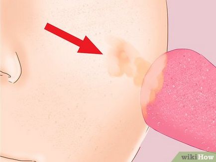 Cum de a camufla cicatrici acnee