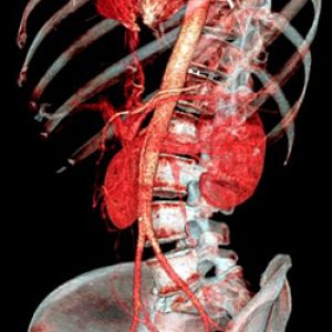 Tomografia computerizată de pregătire vasculară, comportament
