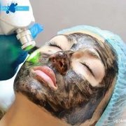 Laser Peelingul facial - descrierea, contraindicații, foto, comentarii, preturi