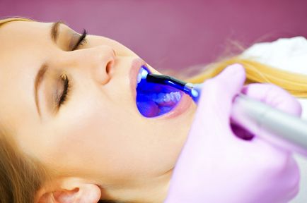 tratamentul cu laser de avantaje și dezavantaje cariilor dentare