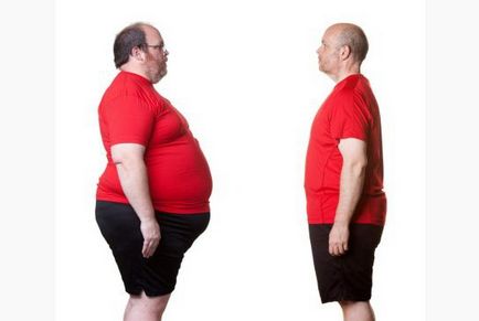 Obezitatea 3 grade - la fel ca multe kg determina gradul de obezitate