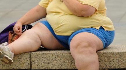 Obezitatea 3 grade - la fel ca multe kg determina gradul de obezitate