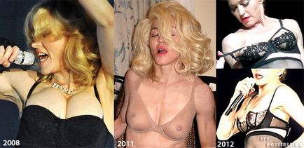Chirurgia plastica Madonna (Madonna mamoplastia) Chirurgie plastica Madonna