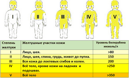 bilirubină la sugari cauze