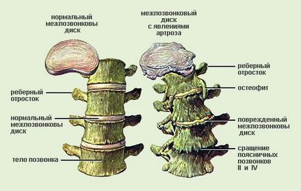 Beneficiile tratamentului herniilor spinarii in clinici private