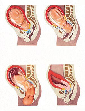 La ce colul uterin intră în travaliu