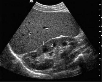 Descifrarea standarde cu ultrasunete de rinichi pentru femei și bărbați