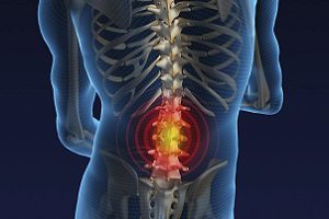 remedii populare Rețete de la hernia a coloanei vertebrale lombare