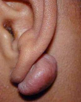 Perlele după ureche că poate fi astfel