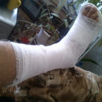 Cum să meargă într-un ghips turnat cu un picior rupt (se aplică pentru gips) Cum să meargă în ghips, cu un picior rupt