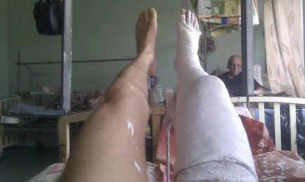 Cum să meargă în ghips, cu un picior rupt (ipsos) Cum să meargă în ghips, cu un picior rupt