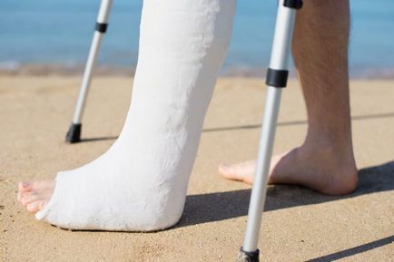 Cum să meargă în ghips, cu un picior rupt (pe termen poartă ipsos) Cum să meargă în ghips, cu un picior rupt