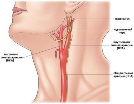 Trifurcation arterei carotide interne