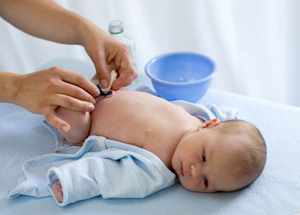 Îngrijirea plăgii ombilical nou-născut