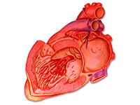 angina vasospastică (aceeași variantă, Prinzmetal spontană)