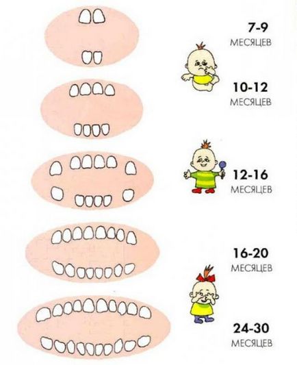 În ce ordine urca dinții într-un copil și la ce vârstă sunt acolo excepții