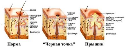 Inflamarea cauze ale pielii, tratament masca de casă