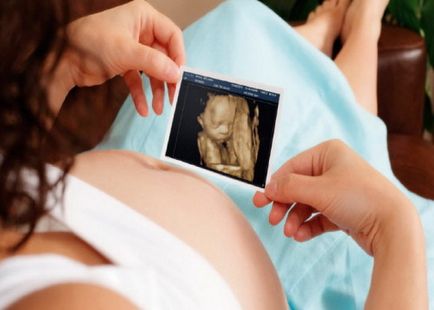 ecografie Harm in timpul sarcinii - Sarcina