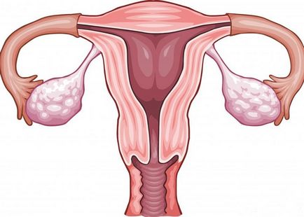 Ovarele la femei locație, în cazul în care dimensiunea, funcția