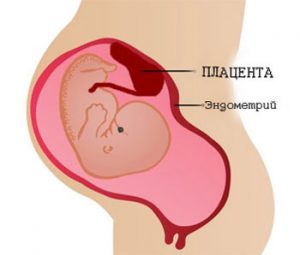 hiperplazie endometriala glandulara ce este