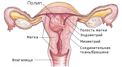 glandulară diagnostic polip endometrial fibroasa si tratament