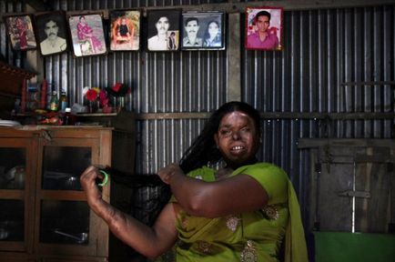 Viața serie de fotografii șocante, care a reprezentat portrete de femei ale căror fețe și organisme deraiat