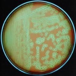 Staphylococcus aureus remedii populare de tratament