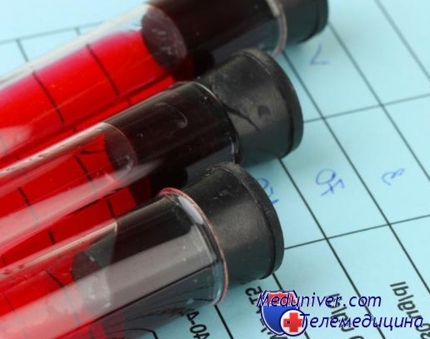 Analiza biochimică a sângelui la rata copilului