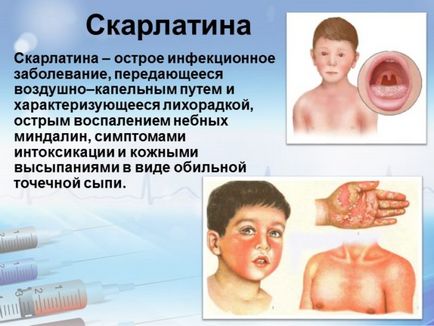 Tratamentul de rinichi la copii