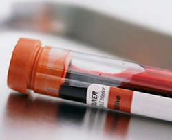Testele de sânge biochimice la câini