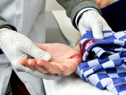 Cum de a păstra sânge Cum de a păstra sânge