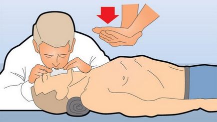 Cum de a corecta masaj cardiac