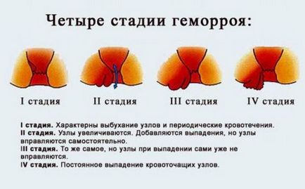 Verificarea gut