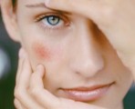 cosmetice acnee rozacee