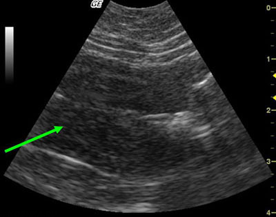 ileus la pisici