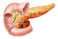 Cum se anesteziază pancreas