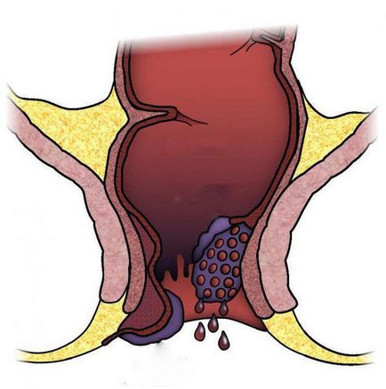 tratamentul chirurgical