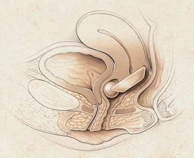 Ce cade uterul