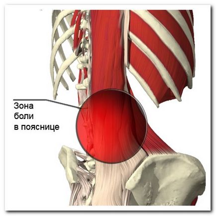Tratamentul coloanei vertebrale lombare sacral