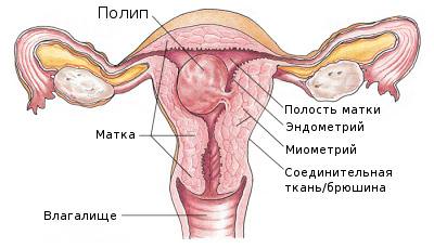 Hysteroresectoscopy ce este