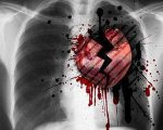 Cum de a provoca insuficiență cardiacă
