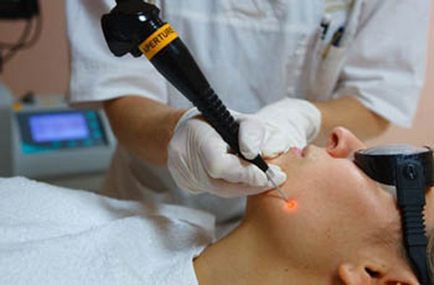 Birthmark sângerează care fac Birthmark sângerează care fac