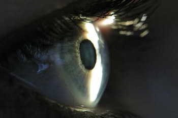 biomicroscop și aplicarea ei în oftalmologie