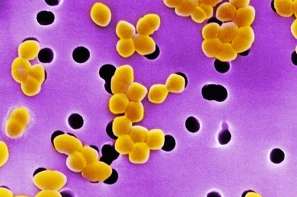 infecție streptococică la copii infecție streptococică la copii